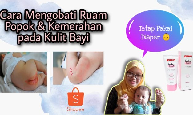 Waspada Ruam Popok Pada Bayi, Ini Cara Pelindung Kulitnya