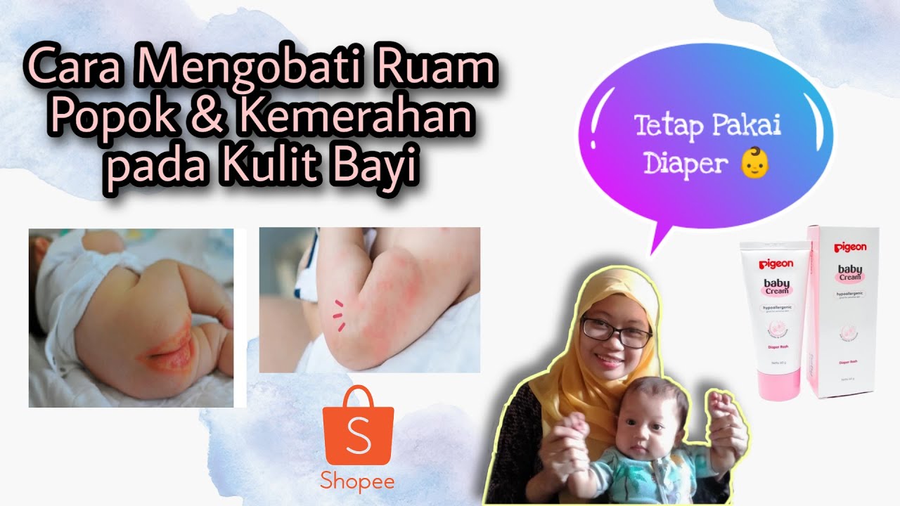 Waspada Ruam Popok